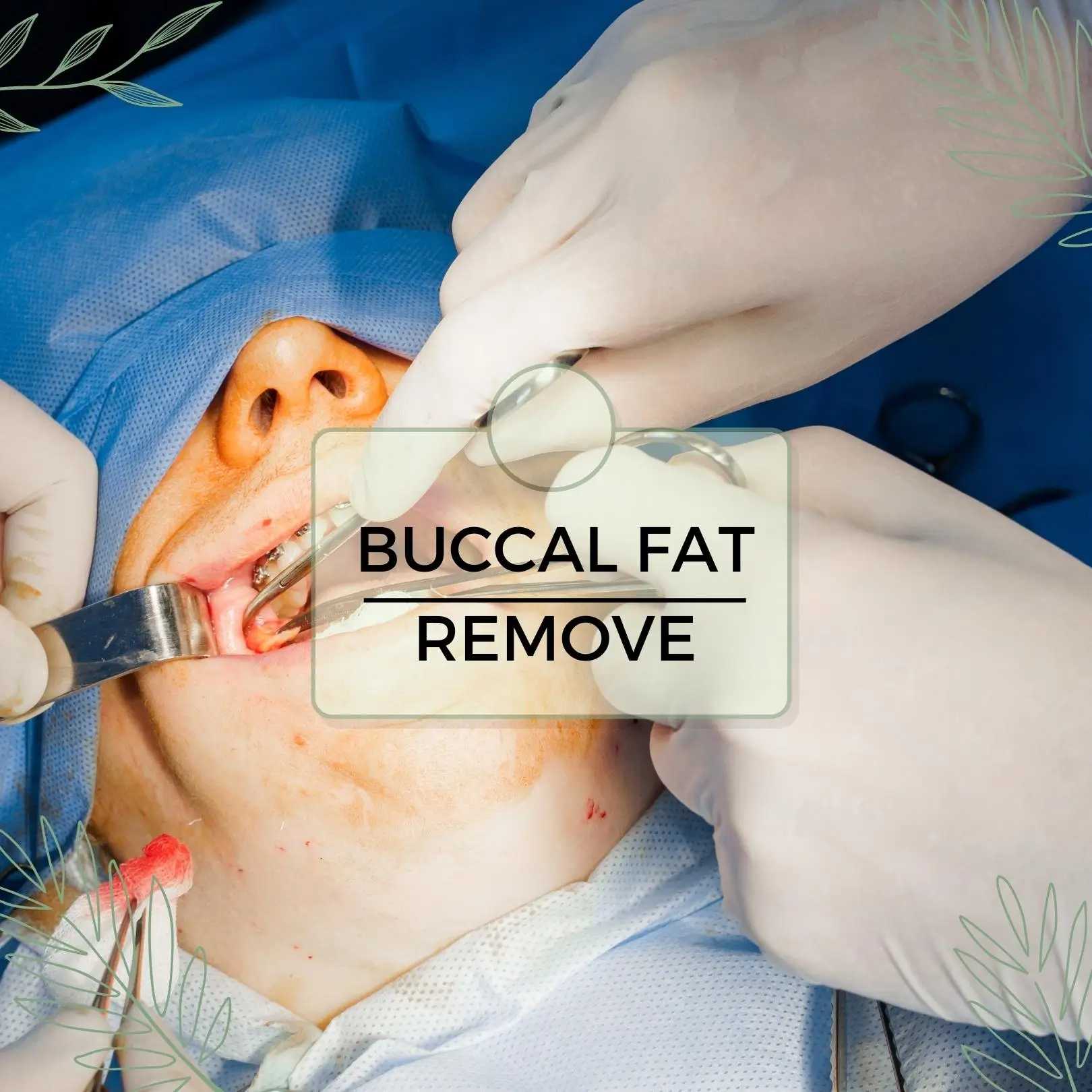 Buccal Fat Remove