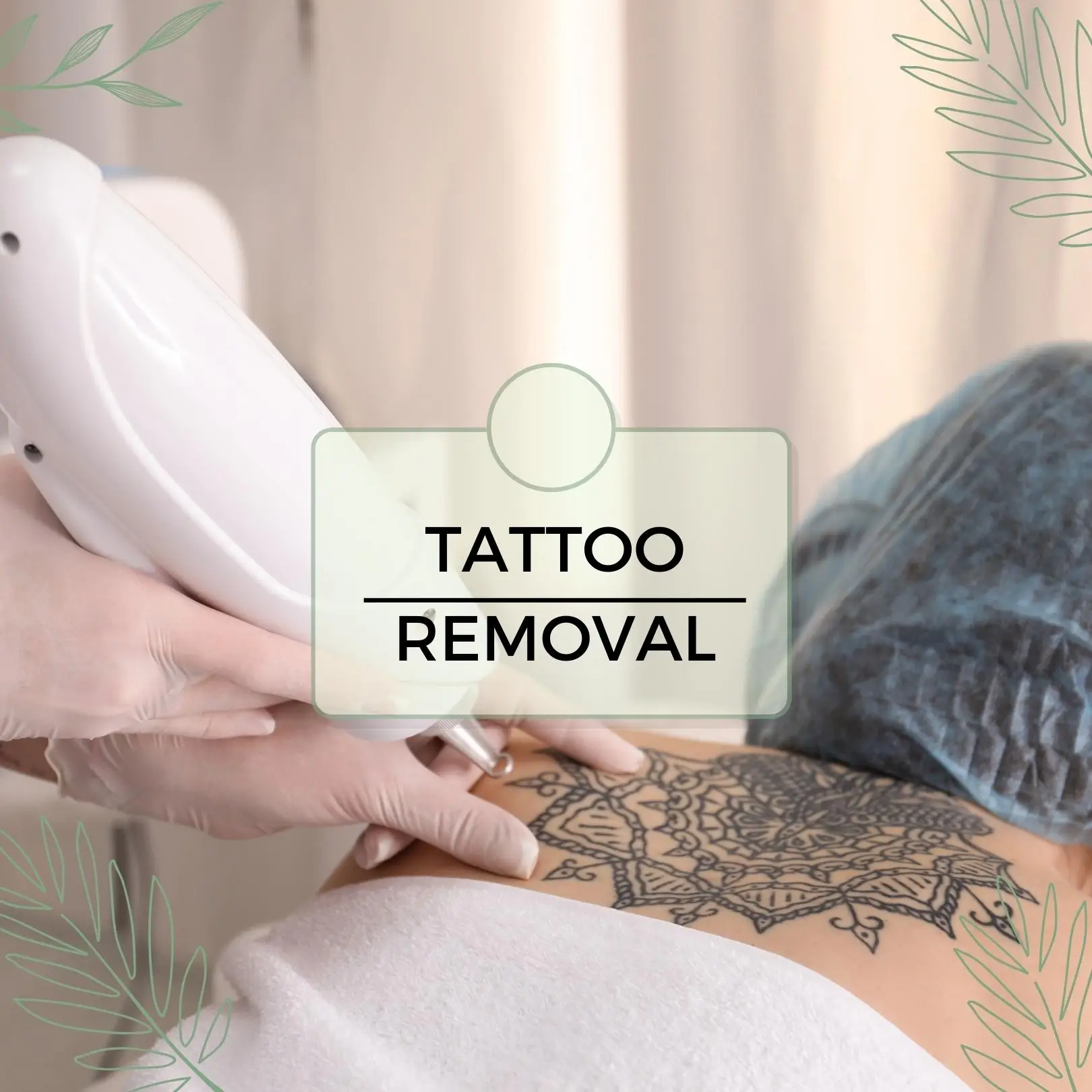 Tattoo Remove